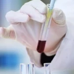 Comment le Gymnema régénère les cellules du pancréas : l’étude Persaud de 1999